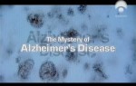 O Mistrio de Alzheimer